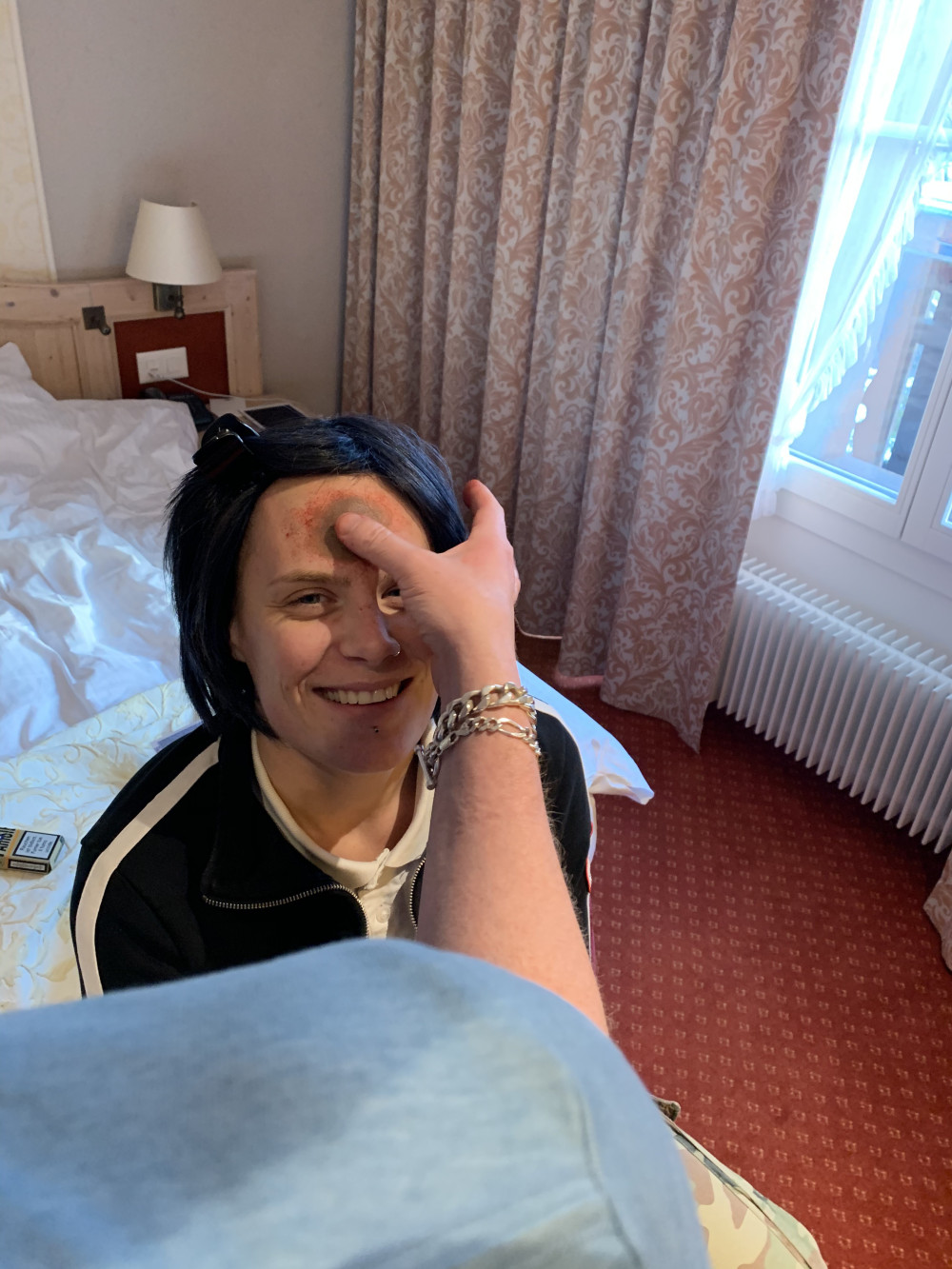 Joëlle Gehrig bekommt eine Wunder auf die Stirn. «Mord auf Seite 3», 2019.